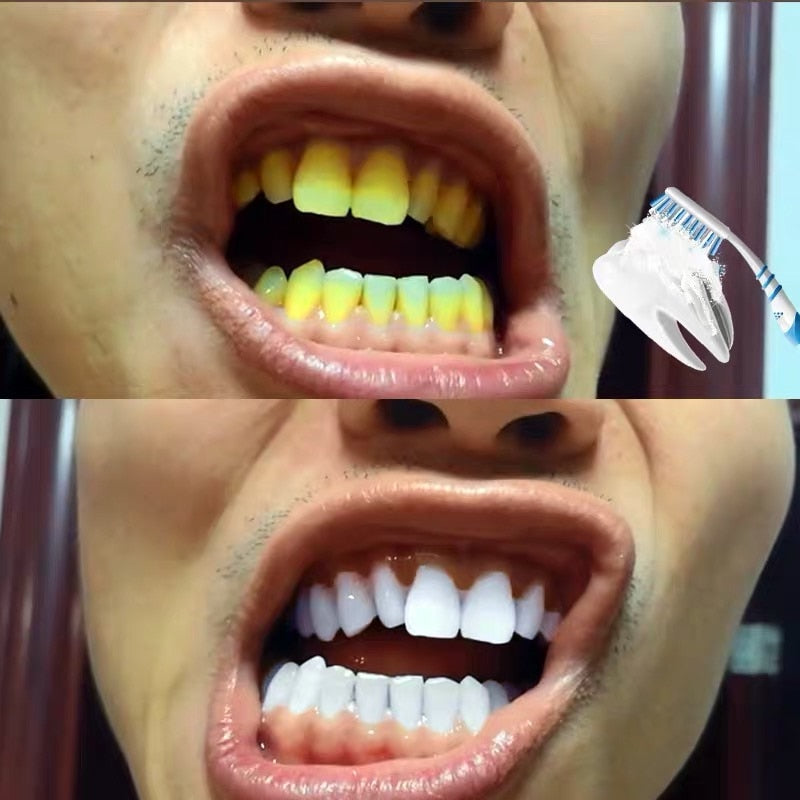 TOOTHPASTE - WHITENING POWDER