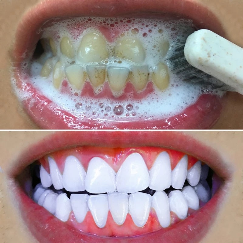 TOOTHPASTE - WHITENING POWDER