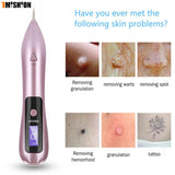 Dark Skin Spot Remover - Tattoo Remover